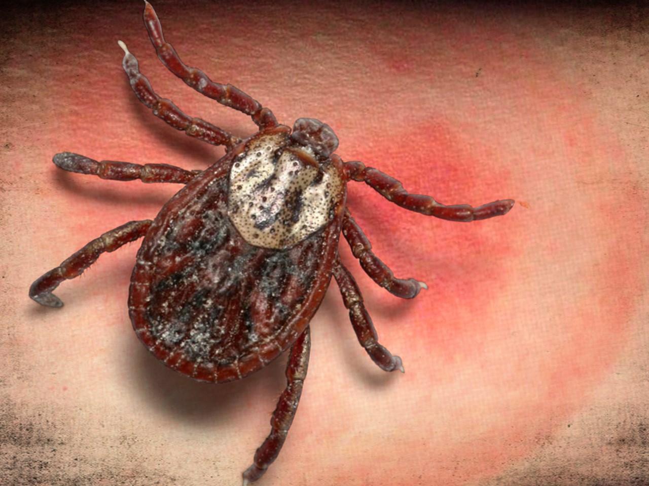 The CDC predicts this may the worst tick season ever